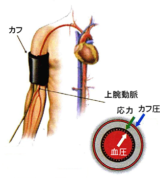 API （Arterial Pressure volume Index)の原理