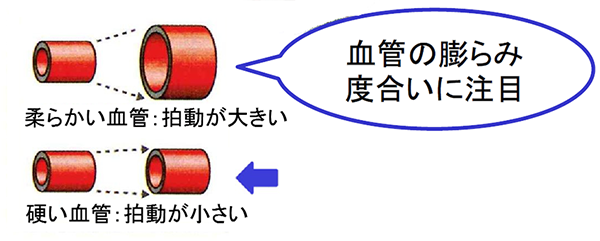 API （Arterial Pressure volume Index)の原理