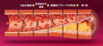 動脈硬化の病態と血管機能検査装置