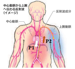 AVI （Arterial Velocity pulse Index)の原理